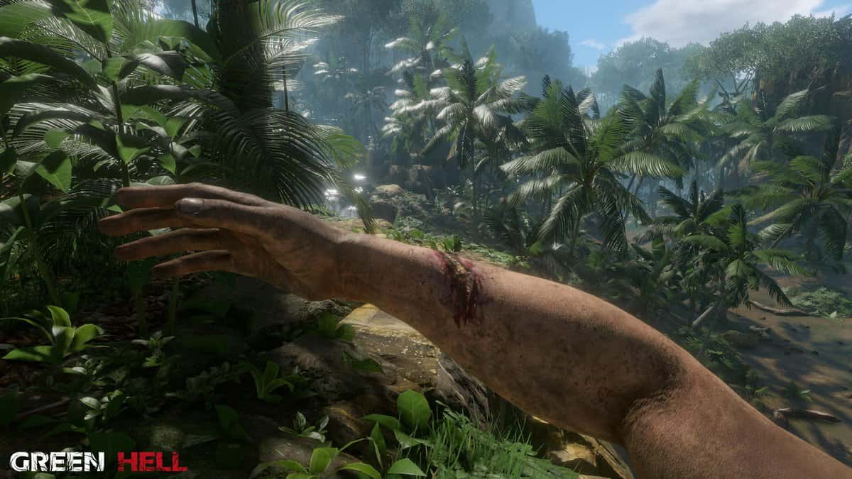 Vue à la première personne d'un bras blessé tendu devant une jungle tropicale ensoleillée dans Green Hell.